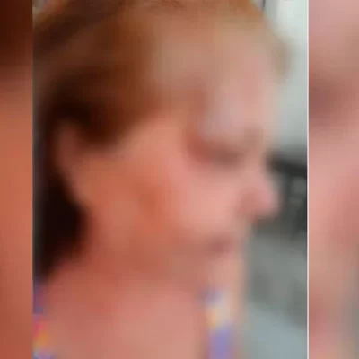 Idosa é agredida e estrangulada por vizinha dentro de elevador de prédio; 'Pensei que ia morrer', diz