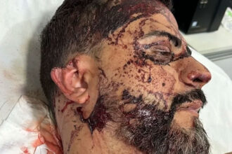 Vereador é torturado dentro de casa e tem parte da orelha cortada durante assalto em Rondonópolis-sindicolegal